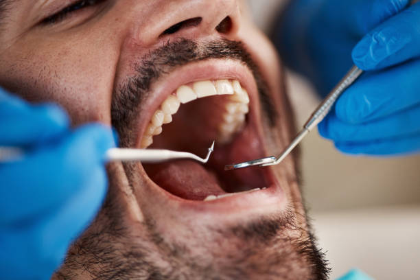 Best Emergency Dental Care for Sports Injuries in Luray, VA